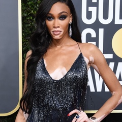 Winnie Harlow, 30 лет, New York City